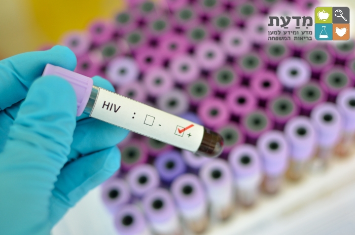 בדיקת HIV: מבחנה עם דם שחיובית ל-HIV
