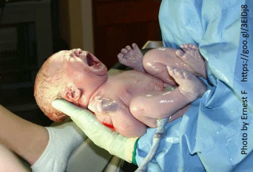 תינוקת מיד אחרי הלידה - כדי לשמור עליה מפני מחלה דימומית, היא תקבל ויטמין K